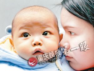 9个月女婴每天流橘黄色泪 原来是得了肝硬化