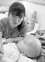 7个月婴儿头比篮球大 父母双双辞职救子