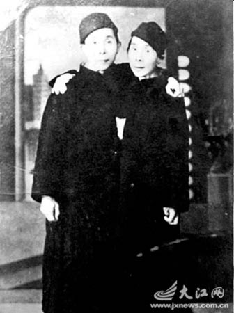 兄弟连体70年各自娶妻生子 一人饮酒两人醉