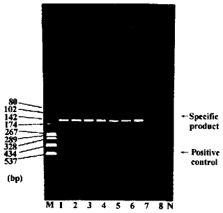 采用 PCR-SSP法检测HLA-B27基因