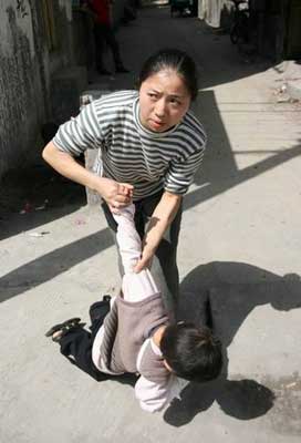 4岁男孩高烧后生怪病见光就跌倒