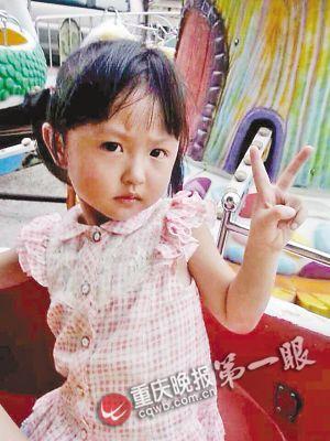 女孩跌进热油桶 父亲错误急救方法加重伤情