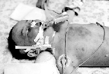 两岁男童被父亲打成脑死亡续：抢救无效身亡