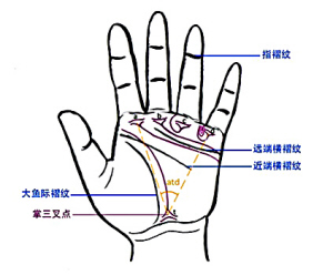 看掌纹诊断高血压？胡闹！