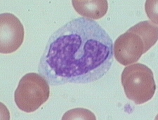 单核细胞直接计数（Monocyte Count）