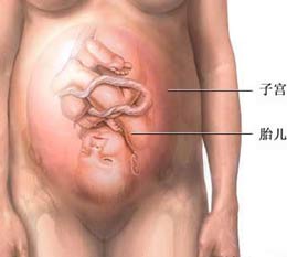 女性分娩直面12个问题