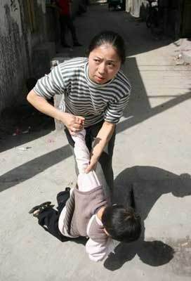 全球最恐怖的67种怪病