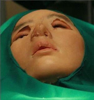 韩国女子整容的术后生活纪实