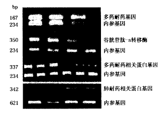 肿瘤耐药相关标志在恶性肿瘤中的表达及意义
