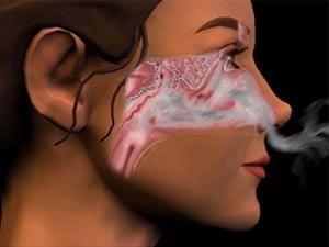 军医带您走出对感冒认识的误区