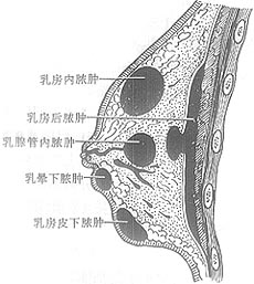乳房脓肿切开引流术