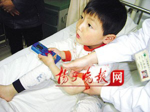 5岁男孩不知疼痛 自残咬掉舌头图