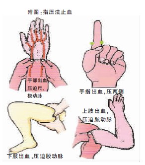清创警惕破伤风，观察肺功防ARDS