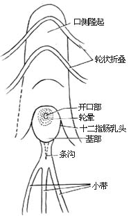 纤维十二指肠镜检查，逆行性胰胆管造影术（ERCP）及经内窥镜括约肌切开术