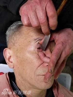 6.师傅在给顾客洗眼，顾客躺着一动不动