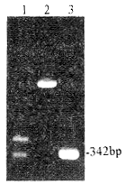 抗登革病毒3型单链抗体的基因克隆表达和免疫学鉴定