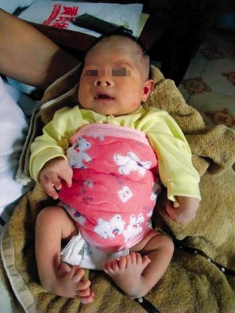 男婴天生每只脚长8个脚趾