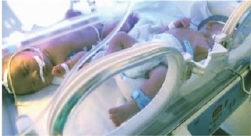 “试管婴儿”扎堆看病 专家建议多胎妊娠者减胎