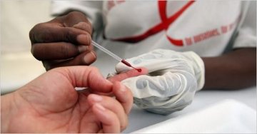 美国研究证实治疱疹药物对灭杀HIV病毒无效