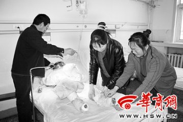 10岁男孩为救堂妹冲入火中被烧成重伤