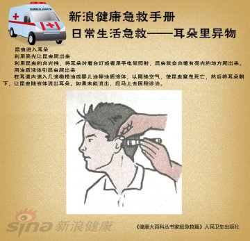 日常生活急救-耳朵异物