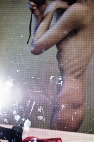 实拍厌食症患者的身体