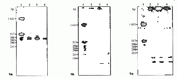 16S～23S rDNA间隔区序列PCR和RFLP分析对分枝杆菌复合菌群鉴定的研究