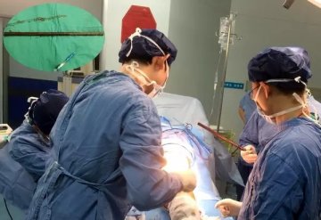 第455医院骨科成功抢救一大腿钢筋贯通伤患者