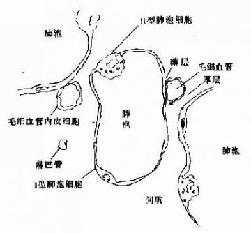 弥散性肺间质疾病
