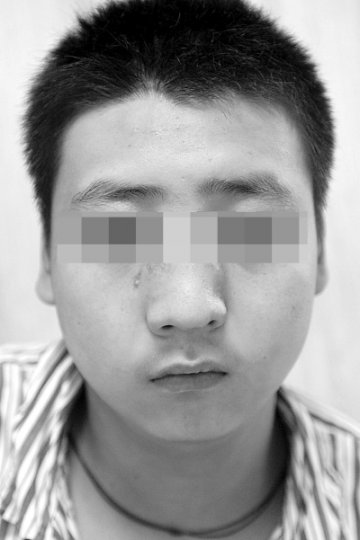 男孩能躲过毛霉病戕害吗