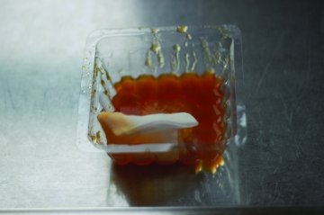 女子吸脂致隆胸填充物流出 双乳大小不一称崩溃