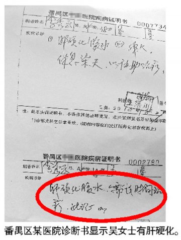 患者被误诊肝硬化 医生：不可能一点错误不犯