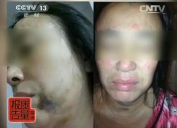 伊美尔非法行医 患者术后昏厥两次