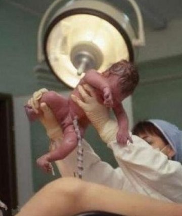 实拍孕妇顺产惊心全过程