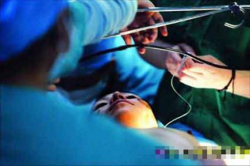 首度公开：男人变女人全程