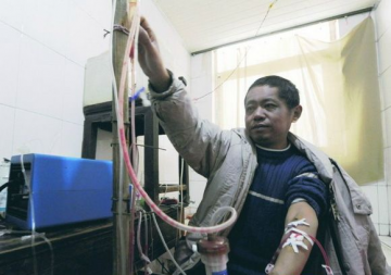 男子自制血透机透析13年 专家支招：腹膜透析可作为首选