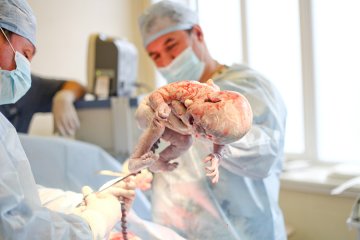 高清：直击年轻母亲剖腹产分娩全过程