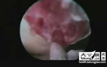 神奇的生命：实拍女性排卵真实过程