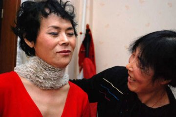 沈阳男子变性手术即将完成 术后被妻子体贴感动