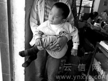 家长称幼子打疫苗后半瘫 治疗时长胡子青春痘
