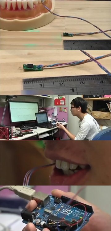 台研发微型健康监控器 可装在牙齿上