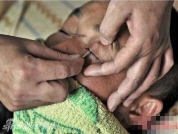 2.师傅在给顾客洗眼，顾客躺着一动不动