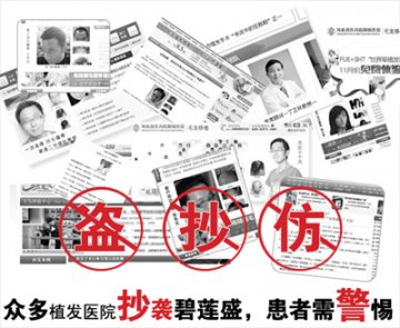 碧莲盛植发医院屡次被模仿 骗子横行患者需引起警惕