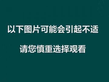 世界最离奇X光大曝光