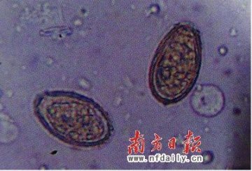 江门280万人染肝吸虫系误传 记者现场勘查