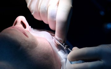 英国多人因植入人工晶体失明 厂家已回收