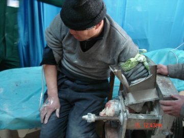 馒头机“咬”住男子手 251医院医务人员及消防官兵成功营救