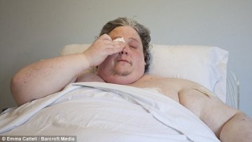 全球第一肥男735斤10年未出门