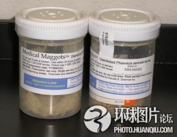 全球最不可思议的“治病”怪招 泰国用蛆治病