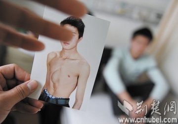 24岁小伙心脏生体外 不忍父亲操劳冒险打工